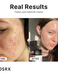 COSRX 15% Niacinamide Face Serum, 0.67 fl oz, Pore Minimizer Serum for Face, Even Skin Tone, Korean Skin Care