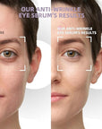 5% caffeine eye cream &