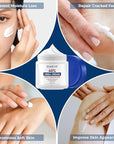 OUKEYA Urea Cream 40 Percent, Foot & Hand Cream for Dry Cracked, Urea Lotion for Feet Maximum Strength(12.35Oz X 2 Packs)