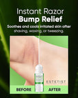 ESTETIST Razor Bump Solution Roll-On for Sensitive Skin, Ingrown Hair & Razor Burn Care Serum with Aloe Vera & Tea Tree, Soothing After Shave Skin Care for Bikini Area, Face, Neck & Legs