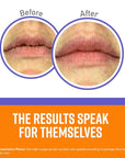 O'Keeffe's Lip Repair Night Treatment Lip