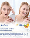 HIQILI 100ML Turmeric Oil for Face Skin Care, Aromatherapy,100% Pure, Use After Dilution- 3.38 Fl Oz
