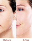 Facial Hair Removal for Women, Painless Face Trimmer for Upper Lips, Peach Fuzz and Chin with USB Rechargeable