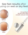 Microplane Colossal Foot File Scraper - The Original Stainless Steel Foot Rasp, Dead Skin/Callus Remover for Feet, Gentle Foot Scrubber, Pedicure Tools for Salon-Quality Foot Care, White