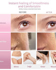 Dermaplane Razor, Face Razors for Women, Dermaplaning Tool for Women Face, Remove Facial Hair and Perfectly Shape Brows, with Protective Cover, 5 Count, Pink