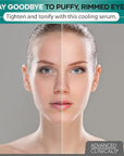 Advanced clinicals puffy eyes treatment