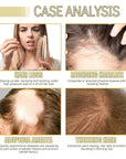 180ML Natural Hair Growth, Rosemary Oil for Hair Growth Organic, Rosemary Oil for Dry Damaged Hair and Growth Thin Hair (3PCS)