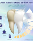 GuruNanda Teeth Whitening Strips - 7-Day Treatment with Non-Slip, Dry Strip Technology - Whitening Designed with Care for a Brighter Smile