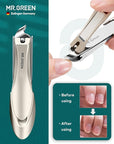 MR.GREEN 8-in-1 Manicure Set– Professional German Stainless Steel Nail Care Kit with Splash-Proof Nail Clippers, Toenail Clippers, Cuticle Tools, Travel Grooming Kit for Men & Women with Leather Case