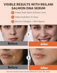 PDRN Salmon DNA Serum β Anti-Aging Face Serum with Hyaluronic Acid, Tripeptide & Vitamins (10,000ppm) β Hydrating Facial Serum for Blemishes, Collagen Boost & Fine Lines β Korean Skincare β 1 Fl Oz