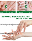 Ginger Nail Treatment, Nail Treatment,
