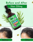 Clean Beauty Rosemary Hair Oil For Growth with Castor Oil Batana Oil Pumpkin Seed Oil Peppermint Oil Silica Biotin Collagen Keratin Saw Palmetto Horsetail Tea Tree Vit E Aloe Vera Jojoba (1 Pack)