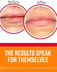 O'Keeffe's Medicated Lip Repair Seal &
