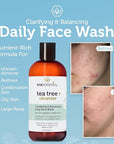 Era Organics Purifying Tea Tree Oil Face Wash - Balancing Cleanser for Oily, Blemish-Prone Skin with Salicylic Acid - Sulfate-Free, Fragrance Free, Made in USA