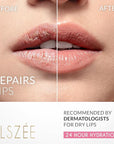 ELSZÉE Loveable Lips | Lip Mask with Hyaluronic Acid | Smooth, Volumize and Hydrate Dry Lips | Day & Night Treatment