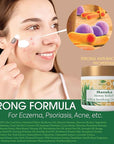 Green Leaf Naturals - Manuka Honey Face Cream - 4oz -Aloe Vera - Jojoba Oil Infused - Body Cream - Gluten Free Moisturizer for Kids & Adults - Nourishing Skin Care
