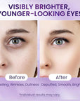 Caffeine & Retinol Under Eye Serum – Dermatologist-Tested, Fast Absorbing, Correction for Puffy Eye Bags Fine Lines Dark Circles Wrinkles While Providing Moisturizing Care