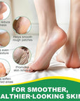 Heel Balm for Dry Cracked Feet (Aloe Vera), Urea Cream 60% Foot Balm Stick for Cracked Heel Repair - Moisturizes, Exfoliates, and Softens Dry, Thickened Skin, Callus Remover for Feet