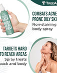 Salicylic Acid Back & Body Acne Spray, Back Acne Solution For Women And Men, Acne Body Spray with Tea Tree Oil, Fast-Drying Back Acne Spray, Fine Mist, Back Acne Treatment Spray, 4 fl oz, 2-pack