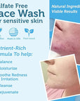 Era Organics Manuka Honey Face Wash for Sensitive Skin - Sulfate Free Gentle Cleanser with Organic Aloe Vera, Hyaluronic Acid & More - Soothing & Moisturizing for Dry Skin - Made in USA (4 oz)