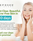 Exposed Skin Care Clearing Tonic Facial