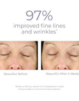 Derma e anti-wrinkle eye treatment