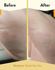 Eczema honey itch cooling face