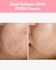 Pink Peptide 12 PDRN Serum With Salmon DNA PDRN 10,320ppm, 12 Peptides, Niacinamide, Skin glow, Hydrating, Moisturizing, Firming, Uneven Skin Tone, Korean Skincare, 33ml, 1.11 fl.oz.