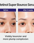 IOPE Retinol Super Bounce Serum - Korean Retinol Eye Cream, Intensive Reactivating Korean Retinoid, Anti-Aging, Reduction in Fine Wrinkles, Beginner Friendly, 1.01 Fl Oz.