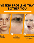 Turmeric retinol eye stick,eye balm