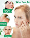 8PCS Aloe Vera Gel for Face & Skin,Organic Aloe Vera Gel,Hydrating After Sun Cream for Travel Size,Moisturizing Lotion for Skincare,After Sun Lotion for All Skin Type(F)