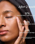 Renewing Eye Serum, Firming Hydrating Eye Cream with Bakuchiol Caffeine Hyaluronic Acid for Reduces Fine Lines, Dark Circles & Puffy Bags, Eyes Care with Zamak Applicator, 0.5 fl. oz