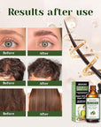 Aeshory Hair Oil - 5 IN 1 Hair Care Oil with Rosemary, Castor, Argan, Vitamin E, and Avocado for Hair Growth and Strengthening - Nourishing and Volumizing 3.38 fl oz