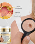 Bee venom cream for removing