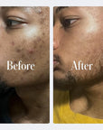 Geologie Clear System | 3-Step Acne