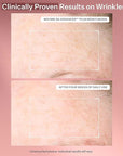StriVectin Anti Wrinkle Trio Kit for Face and Eyes, 3 piece kit with SD Plus Moisturizer, Peptide Plump Line Face Serum, and Intensive Eye Concentrate Wrinkle Cream