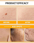 Bee venom cream for removing