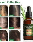 Pure Rosemary Oil Blended with Castor, Sesame, Jojoba and Grapeseed Oils to Promote Hair Growth, Biotin and Strengthen Hair, Dark Glass Bottle with Dropper 2Fl Oz