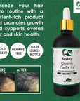 Seddy Organic Castor Oil - Cold Pressed | Hexane-Free | Pure | Hair, Scalp, Eyelashes, Eyebrows, Skin, & Nails | Hair Treatment Oil - 3.4 Fl. Oz