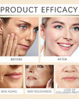 2 Pcs Bee Venom Skin Cream, Anti-Aging Face for All Skin Type Wrinkle Removal & Firming Moisturiser Cream