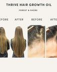 Forest & Shore Hair Growth Oil, 100% Natural, with Caffeine, Biotin, Castor , Argan & Rosemary, Effective Serum for Damaged Hair