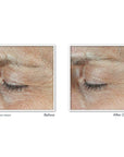 Roc derm correxion dual eye