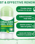 Heel Balm for Dry Cracked Feet (Aloe Vera), Urea Cream 60% Foot Balm Stick for Cracked Heel Repair - Moisturizes, Exfoliates, and Softens Dry, Thickened Skin, Callus Remover for Feet