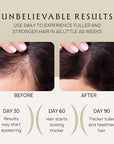 Hair Growth Oil Spray - 100% Pure Ingredients For Non Greasy, Thicker & Stronger Hair - Organic Batana, Castor, Biotin, Saw Palmetto, and Rosemary Oil for Men & Women Scalp - 4.1 Fl Oz