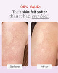 First Aid Beauty KP Bump Eraser Body Scrub 4 oz