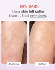 First Aid Beauty KP Bump Eraser Body Scrub 8 oz