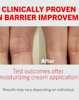 ATOPALM | Intensive Moisturizing Cream | Face & Body Moisturizer | For Dry & Sensitive Skin | Paraben-Free Lotion | Replenishes Hydration | Skin Barrier Repair | Korean Skin Care | 3.4 fl oz (100ml)