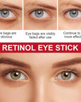 Retinol eye stick - with