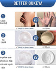 OUKEYA Urea Cream 40 Percent,Foot & Hand Cream for Dry Cracked,Urea Lotion for Feet Maximum Strength
