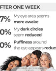 M. Asam MAGIC CARE Perfect Eye Serum - eye serum with 360° tightening effect, effectively fights puffiness & dark circles, tightens the eyelid, eye care with hyaluronic acid complex, 0.84 Fl Oz